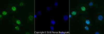 NIH3T3 cells were fixed for 10 minutes using 10% formalin and then permeabilized for 5 minutes using 1X PBS + 0.5% Triton-X100. The cells were incubated with 53BP1 Antibody at 2 ug/ml overnight at 4C and detected with an anti-rabbit Dylight 488 (Green) at a 1:500 dilution. Nuclei were counterstained with DAPI (Blue). Cells were imaged using a 40X objective.